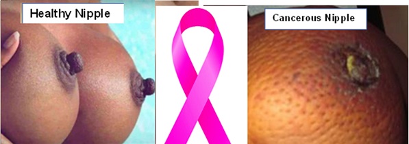 October is breast cancer awareness month